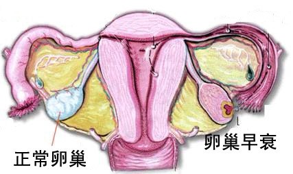 卵巢状况对比图